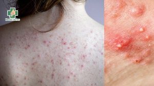 thay chăn ga gối đệm